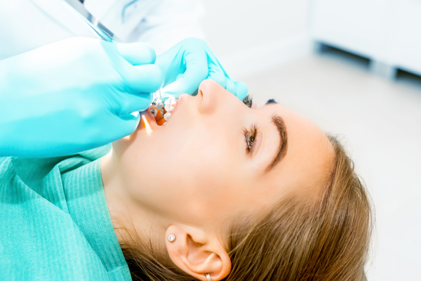 Top   Advantages Of Invisible Braces