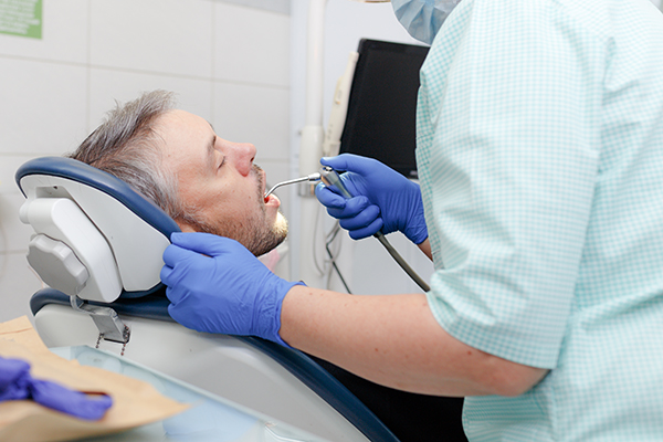 Oral Care Tips To Avoid Needing A Tooth Filling