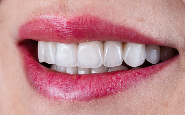 How A Smile Makeover Can Restore Confidence In Your Teeth